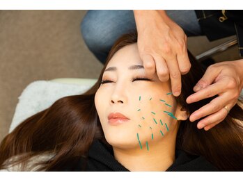 北梅田美容鍼灸院/【大阪/梅田】美容鍼灸