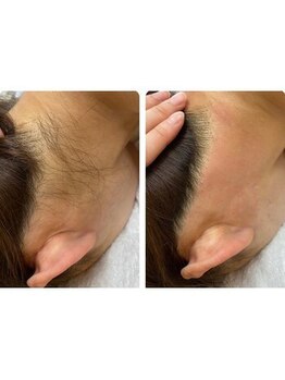 ミモザ(MIMOZA)/もっと自信が持てる後ろ姿に♪