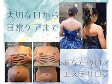 ベルココレ(Bellecocole)