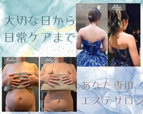 ベルココレ(Bellecocole)