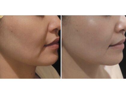 Nビューティーの写真