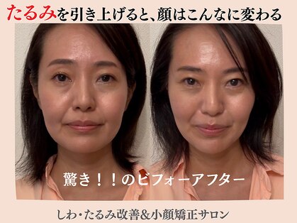 エンジェルエッグの写真