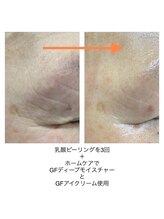 ベッラドンナ(Bella donna)/目元周りのお悩みに　ホームケア