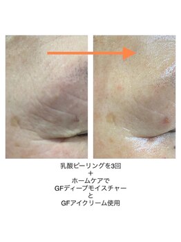 ベッラドンナ(Bella donna)/目元周りのお悩みに ホームケア