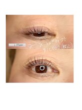 デイジー(DAY'S EYE)/パッチリ