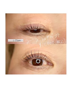 デイジー(DAY'S EYE)/パッチリ