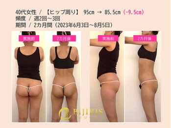 骨盤底筋ジム/ビフォーアフター