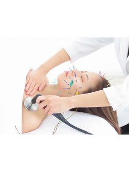 鍼灸施術を受けたい