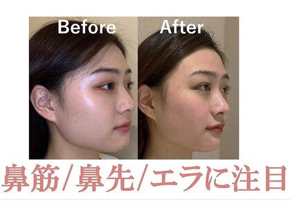ラプリ 横浜店(Raplit)の写真