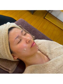 ハーブピーリングHY/毛穴すっきりゴマージュ