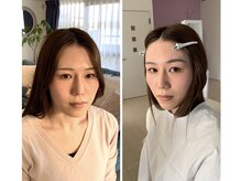 ジブンビューティー(jibun beauty)/ビフォーアフター