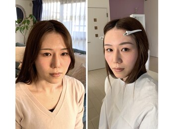 ジブンビューティー(jibun beauty)/ビフォーアフター