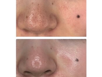 ビューティーサロンリノ 三宮店(Lino)/