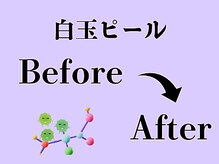 ビースキン 広島(BE:SKIN)/乳酸菌ピーリング/毛穴ケア