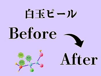 ビースキン 広島(BE:SKIN)/乳酸菌ピーリング/毛穴ケア