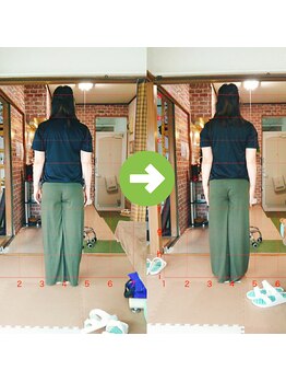 サプライズ整体院/30代ママさんの産後の骨盤初回