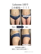 アール(R)/ダイエット&水素