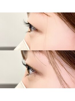 ビームズ トータルビューティー 西中島店(BeeMs Total Beauty)/◇コスメリフト◇