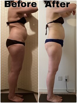 クリスタルビューティー/12回コース