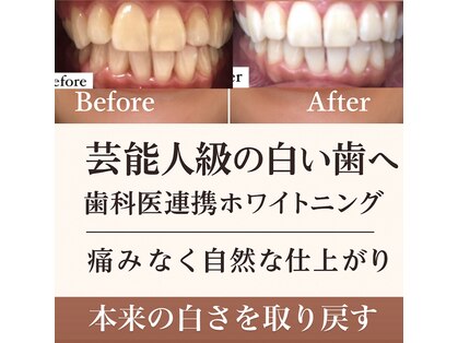 エム(M)の写真