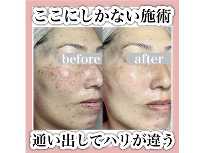 エミュローズ 段原店(Nm' Rose)の写真