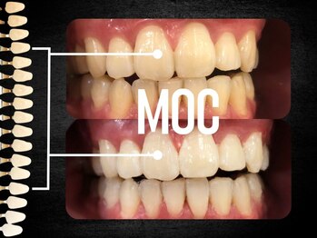 モック 麻布十番(MOC)/ホワイトニング/麻布十番/六本木