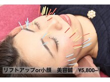 あおき鍼灸整骨院