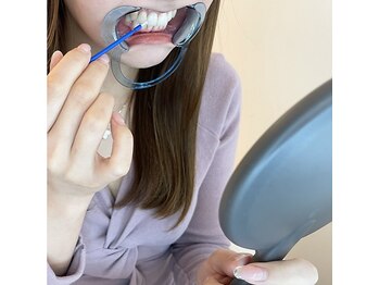 エクシアホワイトニング 中野駅北口店/施術の様子