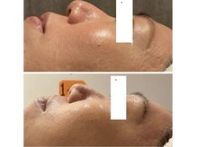 ジョーヌ(JAUNE)/悩み肌から潤い素肌へ