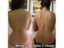 ケイビューティ(k-beauty)の雰囲気（どんな方でもインディバは効果あり【インディバ、痩身、小顔◎】）