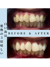 ドルチェ 水戸店(Dolce)/★ before → after ★