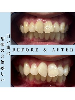 ドルチェ 水戸店(Dolce)/★ before → after ★