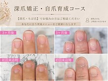 ルシェルアイ