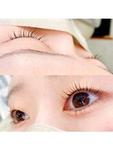 グリン(grin)/メーテルロット