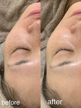 ニコ(25)/ラミピール