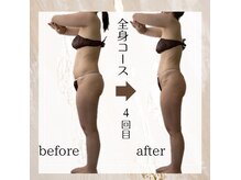 バーチュ(Virtue)の雰囲気（サイズダウンを目指したい！頑固な脂肪に直接アタック！）