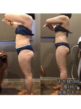 カルム エ コンポーゼ(Calme et Compose')/痩身セルゼロ／全身18回