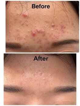 ゆるる(You*ruru)/