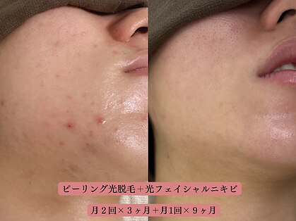 フォーティチュード(FORTITUDE)の写真