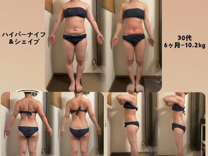 アンジュの写真