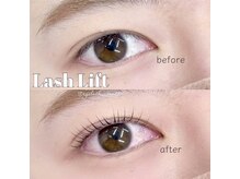 ビーティー(bT)/ラッシュリフト(まつ毛パーマ)