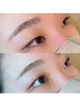 ＊その5＊一重・奥二重の施術が得意