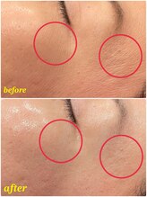 ソルエユニーク(Le seul et unique)/トーンアップ、ハリ、艶★