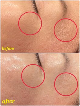 ソルエユニーク(Le seul et unique)/トーンアップ、ハリ、艶★