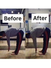 カワル整体 上通り院/急な腰痛を起こした高校生。