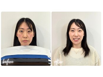 スタイルキューピット(style cupit)/メイクビフォアフター＊30代