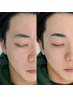【メンズアイブロウワックス脱毛＋眉カット＋眉お手入れ】＋顔WAX脱毛3ヵ所