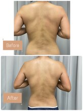 FJ/気になる部分を集中燃焼◎痩身