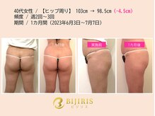 骨盤底筋ジム/ビフォーアフター