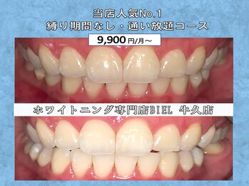 ビエル 牛久店(BIEL)/通い放題コース【2ヶ月ご利用】